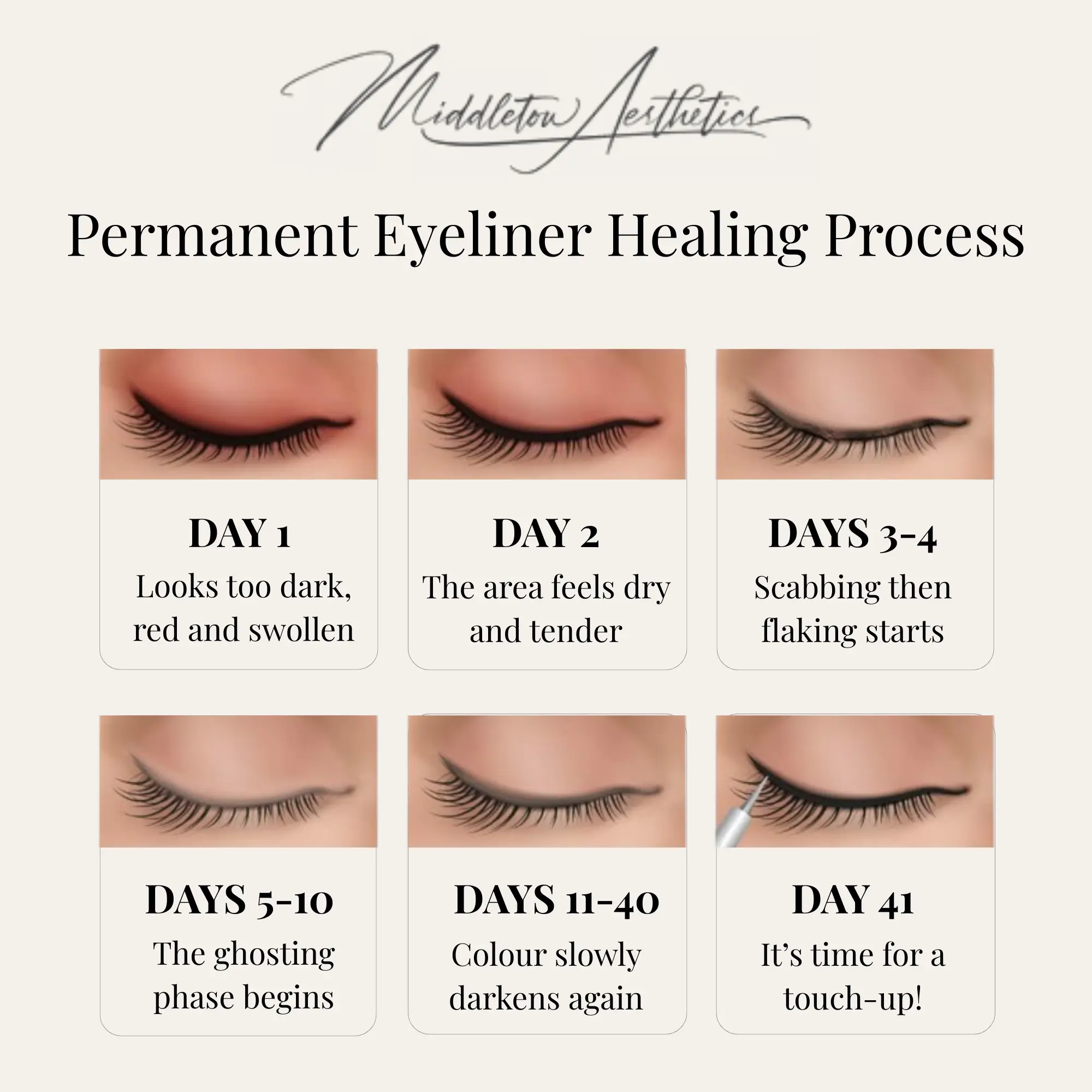 Permanent eyeliner aftercare guide at Middleton Aesthetics Grantham